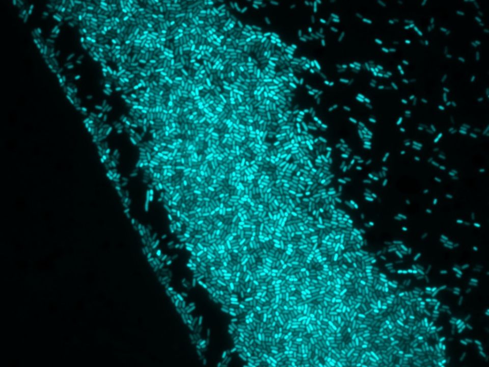 Cellule batteriche al microscopio a fluorescenza